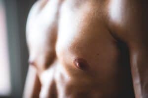 Adult Gynecomastia Surgery Orlando