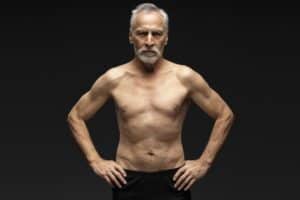 Senior Gynecomastia Surgery Orlando